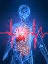 Heartbeat/heartattack Royalty Free Stock Photo