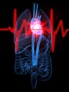 Heartbeat/heartattack Royalty Free Stock Photo