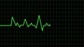 Heartbeat Medical Cardiogram electrocardiogram pulse graph