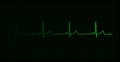 Heartbeat on the monitor