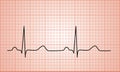 Heartbeat Normal ECG graph Royalty Free Stock Photo
