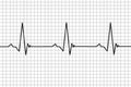 Heartbeat. Pulse simple illustration. Simple illustration concept