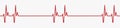 Heartbeat red line icon. Palpitation. Red heartbeat, line of life. Vector illustration