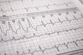 Heartbeat represented on paper. Cardiac arrhythmias. Selective focus on some beats. Free space to write