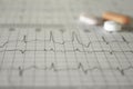 Heartbeat represented on paper. Electrocardiogram with selective focus. Representation of cardiac arrhythmias