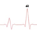 Heartbeat rhythm graph on a white background. Electric cardiogram.