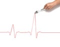 Heartbeat rhythm graph on a white background. Electric cardiogram. High cardio pressure caused by cholesterol Royalty Free Stock Photo