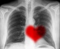 Heartbeat on x-ray