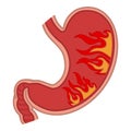 Gastritis of the stomach. Royalty Free Stock Photo