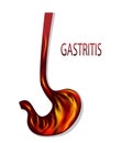 Heartburn, gastritis