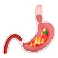 Cross section of stomach with hot flames and red chili pepper Royalty Free Stock Photo