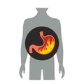 Heartburn in the stomach. flat vector illustration isolated Royalty Free Stock Photo