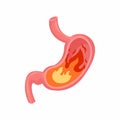 Heartburn in the stomach. Unhealthy stomach concept Royalty Free Stock Photo