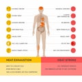 Heat exhaustion and heast stroke infographic Royalty Free Stock Photo