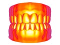 Heath map - denture