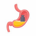 Heaviness in stomach. Isolated vector illustration. Gases problem, gastritis