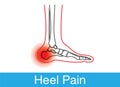 Heel pain outline