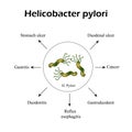 Helicobacter pylori. Diseases caused by Helicobacter pylori. Helicobacter infection. Royalty Free Stock Photo