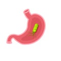Helicobacter Pylori In Stomach Royalty Free Stock Photo
