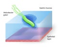 Helicobacter pylori