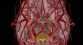 The polygon or circle of Willis is an anastomosis that supplies Royalty Free Stock Photo