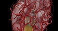 The polygon or circle of Willis is an anastomosis that supplies Royalty Free Stock Photo