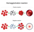 Hemagglutination reaction. Blood typing