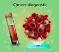 Hematologic Research for Early Cancer Diagnostic