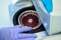 Hematologist in glove removes a cartridge from a laboratory centrifuge