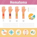 Hematoma. Stages. Isolated Royalty Free Stock Photo