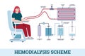 Hemodialysis or kidney dialysis scheme cartoon vector illustration isolated. Royalty Free Stock Photo