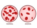 Hemoglobin. Anemia symptoms, blood disease. Health care concept.