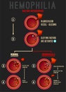 Hemophilia Blood Clotting Process Royalty Free Stock Photo