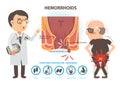 Hemorrhoids