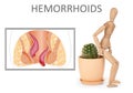 Hemorrhoids. Wooden human figure near cactus and illustration of unhealthy lower rectum on background