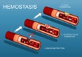 Hemostasis and Wound healing. Coagulation