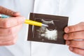 Hepatic or liver cyst on ultrasound image concept photo. Doctor indicating by pen on printed picture ultrasound pathology - hepati