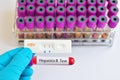 Hepatitis B testing