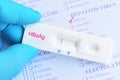 Hepatitis B virus negative test result