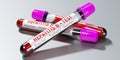 Hepatitis B virus - test tubes, blood tests - 3D illustration