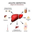 Hepatitis Symptoms