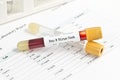 Hepatitis Test Royalty Free Stock Photo