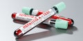 Hepatitis A virus - test tubes, blood tests - 3D illustration