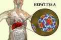 Hepatitis A viruses HAV in liver