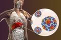 Hepatitis A viruses HAV in liver