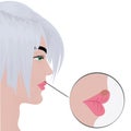 Herpes cold sores on woman`s lips