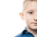 Herpes rash near the eye on a child face. Royalty Free Stock Photo