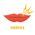 Herpes HSV cold sore lip outbreak medical icon