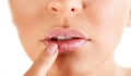 Woman touching her lips with herpes