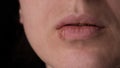 herpes on the lips, a woman with a sore on the lip closeup Royalty Free Stock Photo